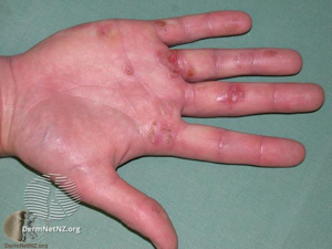 Triage Detect Disease In A Snap